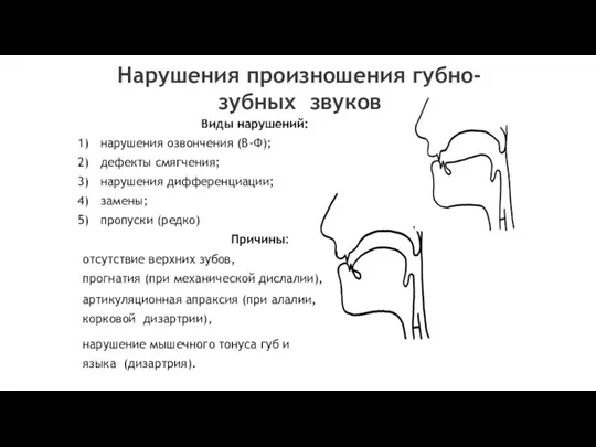 Нарушения произношения губно-зубных звуков Виды нарушений: нарушения озвончения (В-Ф); дефекты смягчения; нарушения