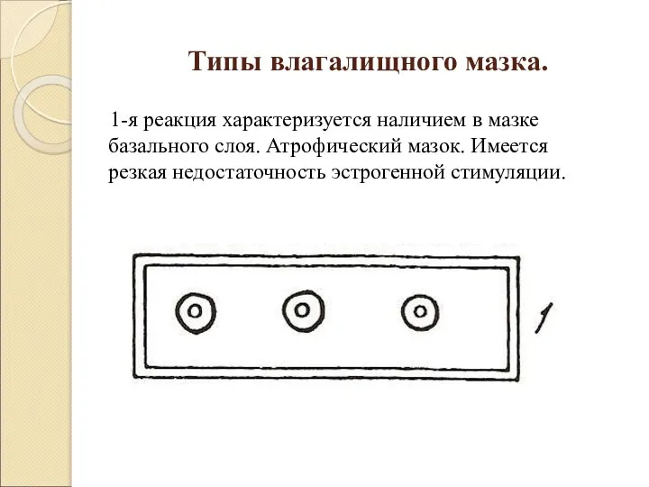 Типы влагалищного мазка. 1-я реакция характеризуется наличием в мазке базального слоя. Атрофический