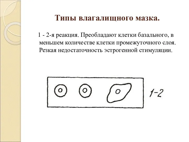 Типы влагалищного мазка. 1 - 2-я реакция. Преобладают клетки базального, в меньшем