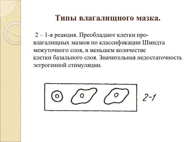 Типы влагалищного мазка. 2 – 1-я реакция. Преобладают клетки про- влагалищных мазков