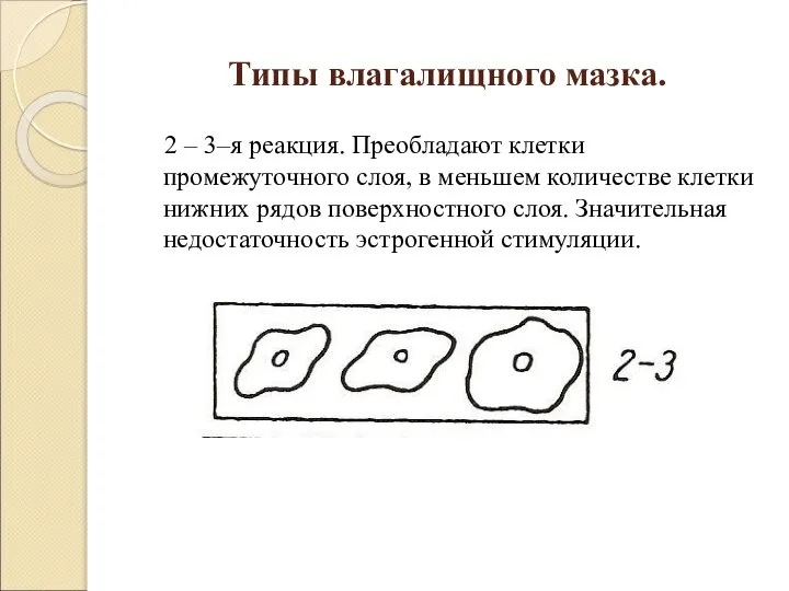 Типы влагалищного мазка. 2 – 3–я реакция. Преобладают клетки промежуточного слоя, в