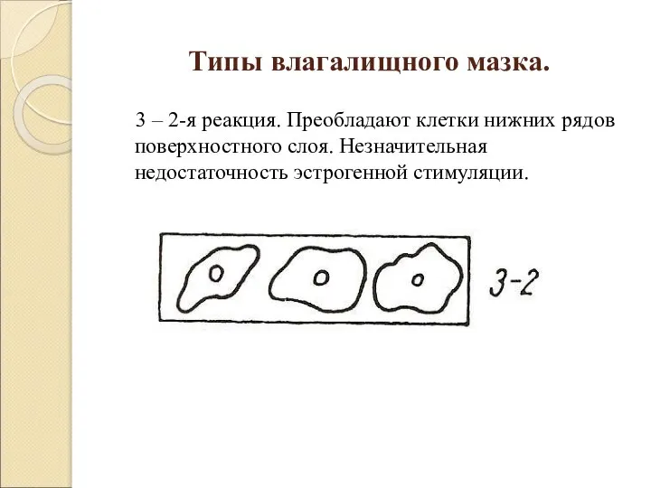 Типы влагалищного мазка. 3 – 2-я реакция. Преобладают клетки нижних рядов поверхностного