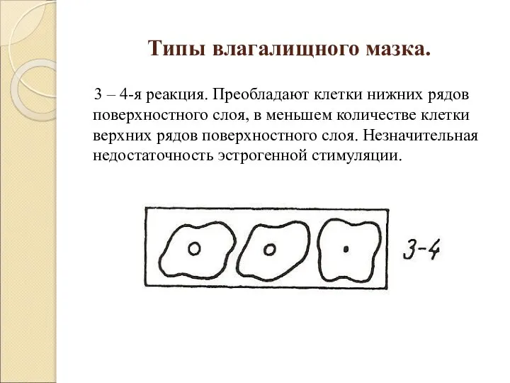 Типы влагалищного мазка. 3 – 4-я реакция. Преобладают клетки нижних рядов поверхностного