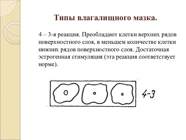 Типы влагалищного мазка. 4 – 3-я реакция. Преобладают клетки верхних рядов поверхностного