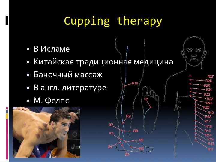 Cupping therapy В Исламе Китайская традиционная медицина Баночный массаж В англ. литературе М. Фелпс