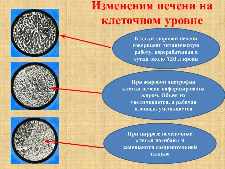 Изменения печени на клеточном уровне Клетки здоровой печени совершают титаническую работу, перерабатывая