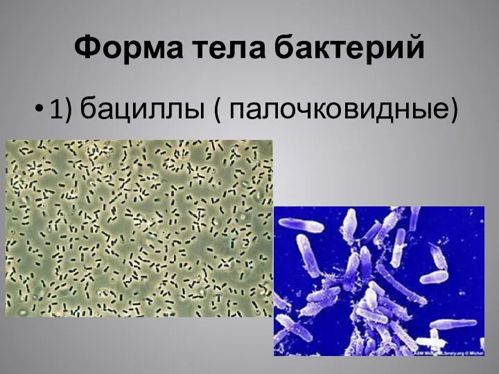 Форма тела бактерий 1) бациллы ( палочковидные)