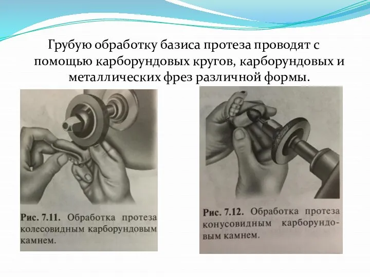 Грубую обработку базиса протеза проводят с помощью карборундовых кругов, карборундовых и металлических фрез различной формы.