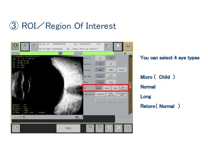 You can select 4 eye types Micro ( Child ) Normal Long