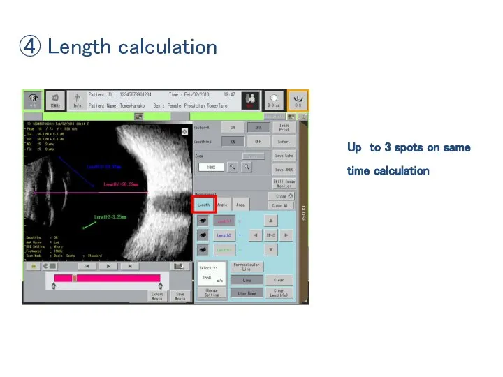 ④ Length calculation Up to 3 spots on same time calculation