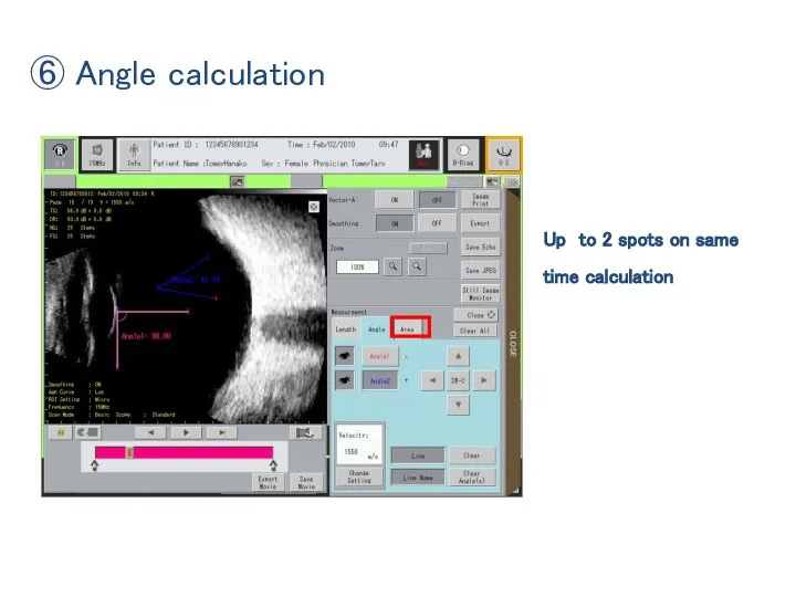 ⑥ Angle calculation Up to 2 spots on same time calculation