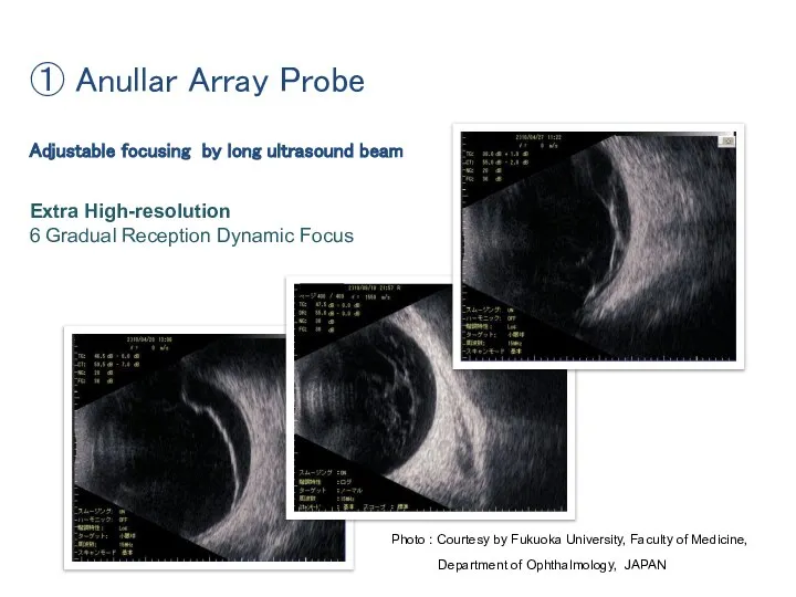 Adjustable focusing by long ultrasound beam Extra High-resolution 6 Gradual Reception Dynamic