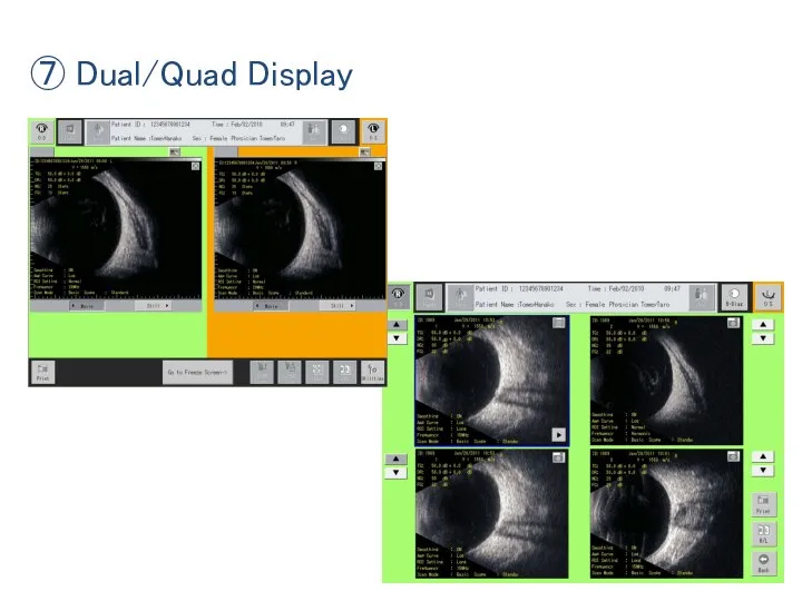 ⑦ Dual/Quad Display