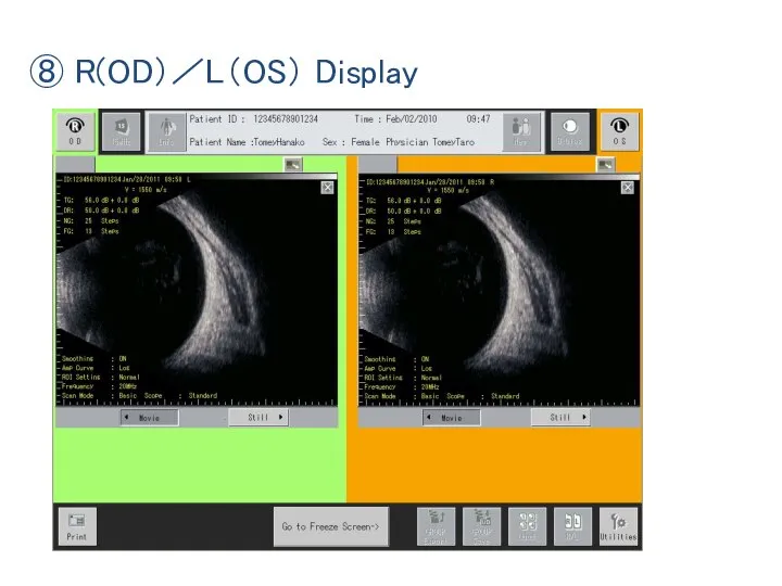 ⑧ R(OD）／L（OS） Display