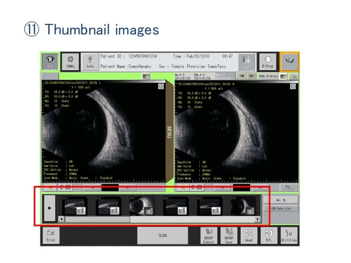 ⑪ Thumbnail images