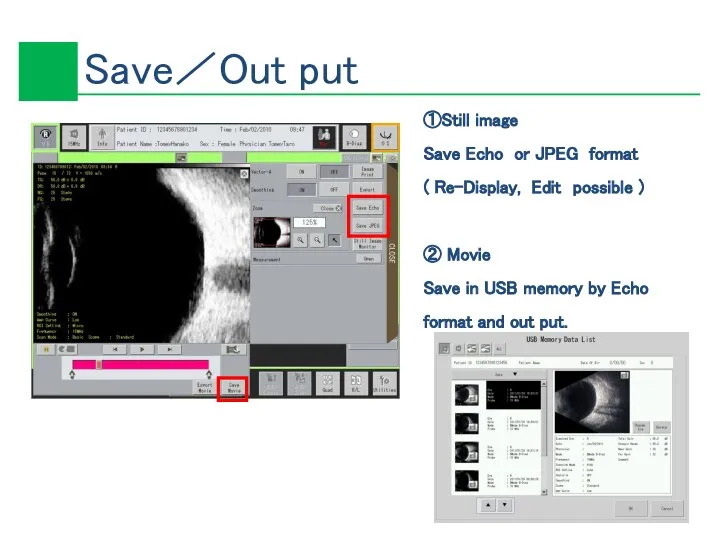 ①Still image Save Echo or JPEG format ( Re-Display, Edit possible )