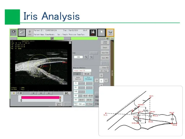 Iris Analysis