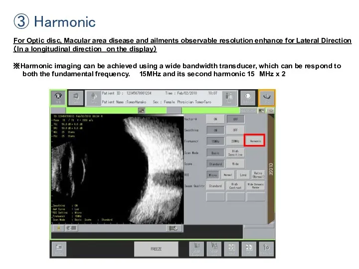 ③ Harmonic For Optic disc, Macular area disease and ailments observable resolution