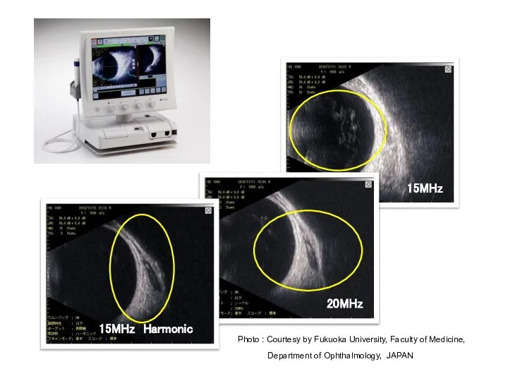 15MHz 20MHz 15MHz Harmonic Photo : Courtesy by Fukuoka University, Faculty of