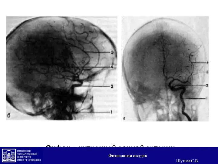 Сифон внутренней сонной артерии Физиология сосудов Шутова С.В.