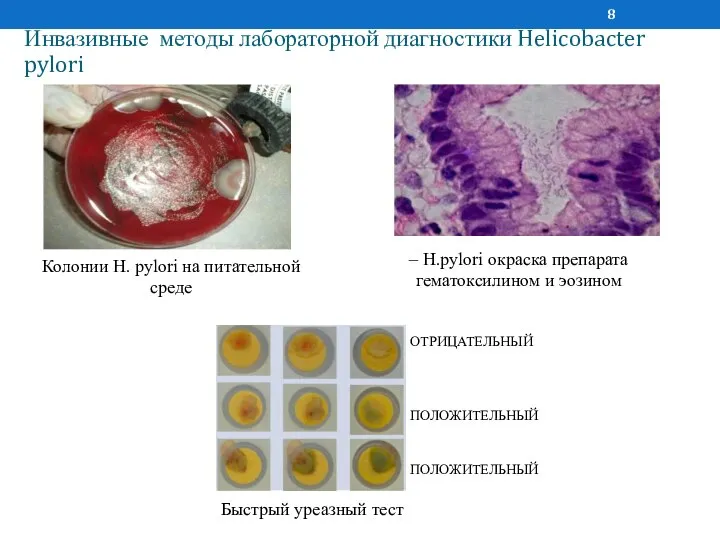 Инвазивные методы лабораторной диагностики Helicobacter pylori Колонии H. pylori на питательной среде