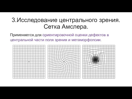 3.Исследование центрального зрения. Сетка Амслера. Применяется для ориентировочной оценки дефектов в центральной