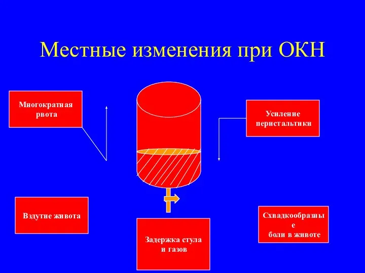 Местные изменения при ОКН Многократная рвота Вздутие живота Усиление перистальтики Схвадкообразные боли