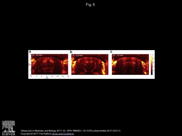 Fig. 5 Ultrasound in Medicine and Biology 2017 43, 1679-1689DOI: (10.1016/j.ultrasmedbio.2017.03.011) Copyright