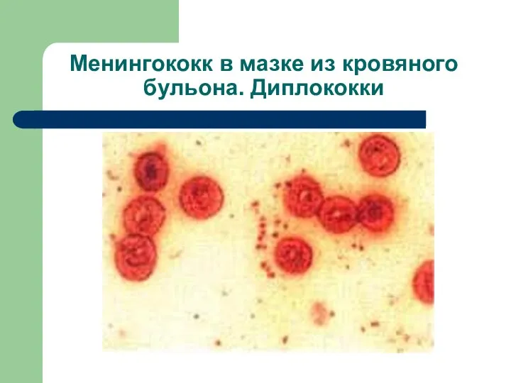 Менингококк в мазке из кровяного бульона. Диплококки