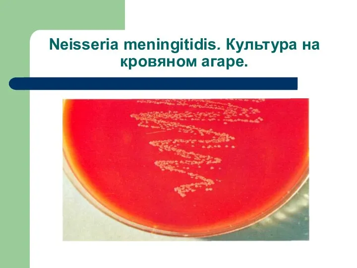 Neisseria meningitidis. Культура на кровяном агаре.