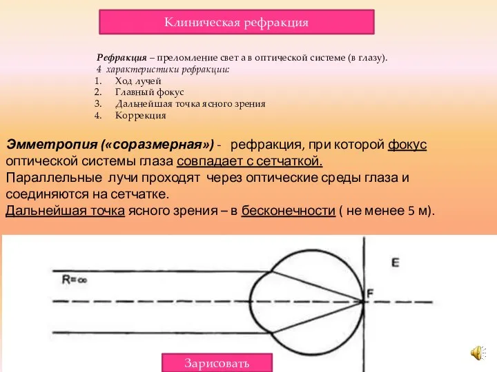 Эмметропия («соразмерная») - рефракция, при которой фокус оптической системы глаза совпадает с