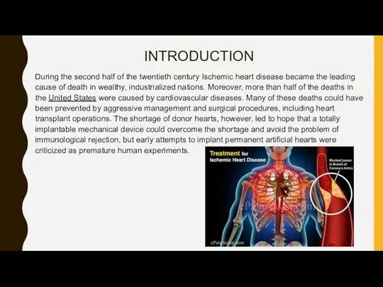 INTRODUCTION During the second half of the twentieth century Ischemic heart disease