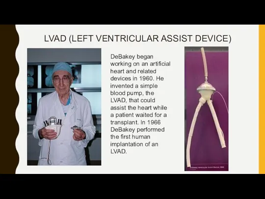 LVAD (LEFT VENTRICULAR ASSIST DEVICE) DeBakey began working on an artificial heart