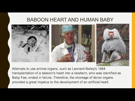 BABOON HEART AND HUMAN BABY Attempts to use animal organs, such as