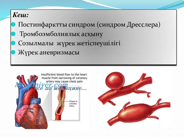 Кеш: Постинфарктты синдром (синдром Дресслера) Тромбоэмболиялық асқыну Созылмалы жүрек жетіспеушілігі Жүрек аневризмасы