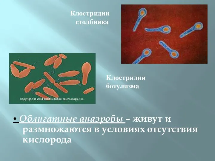 • Облигатные анаэробы – живут и размножаются в условиях отсутствия кислорода Клостридии столбняка Клостридии ботулизма