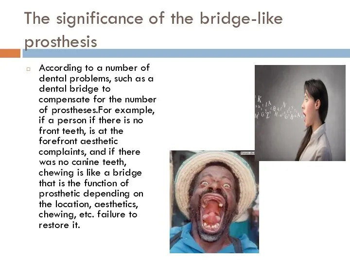 The significance of the bridge-like prosthesis According to a number of dental