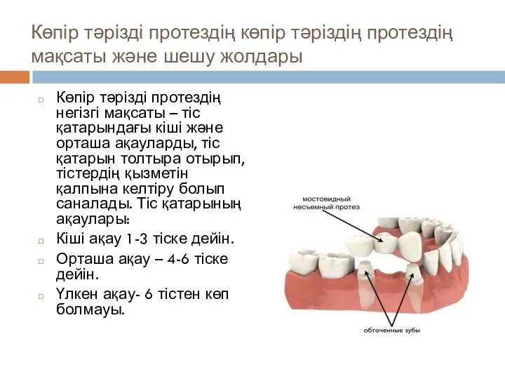 Көпір тәрізді протездің көпір тәріздің протездің мақсаты және шешу жолдары Көпір тәрізді