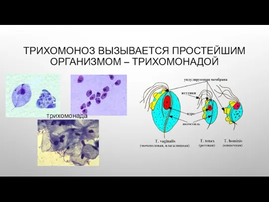 ТРИХОМОНОЗ ВЫЗЫВАЕТСЯ ПРОСТЕЙШИМ ОРГАНИЗМОМ – ТРИХОМОНАДОЙ трихомонада