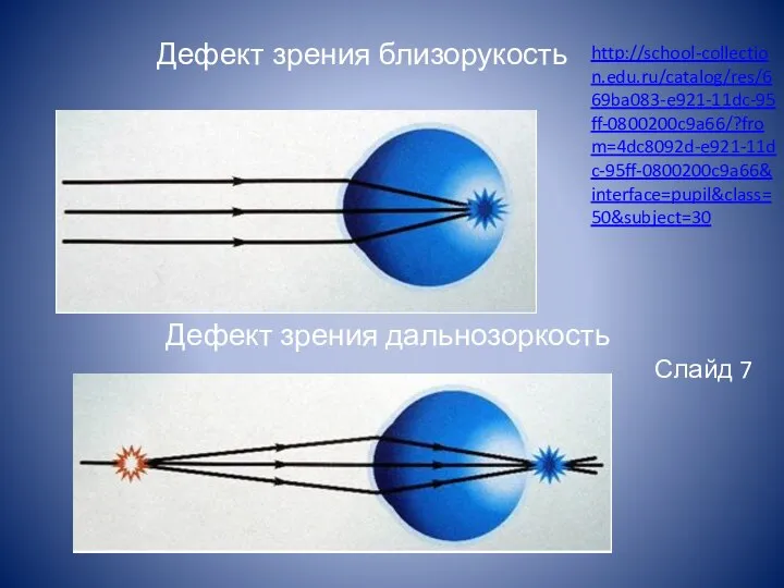 Дефект зрения близорукость Дефект зрения дальнозоркость Слайд 7 http://school-collection.edu.ru/catalog/res/669ba083-e921-11dc-95ff-0800200c9a66/?from=4dc8092d-e921-11dc-95ff-0800200c9a66&interface=pupil&class=50&subject=30