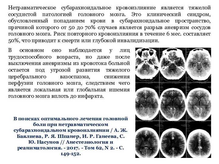 Нетравматическое субарахноидальное кровоизлияние является тяжелой сосудистой патологией головного мозга. Это клинический синдром,