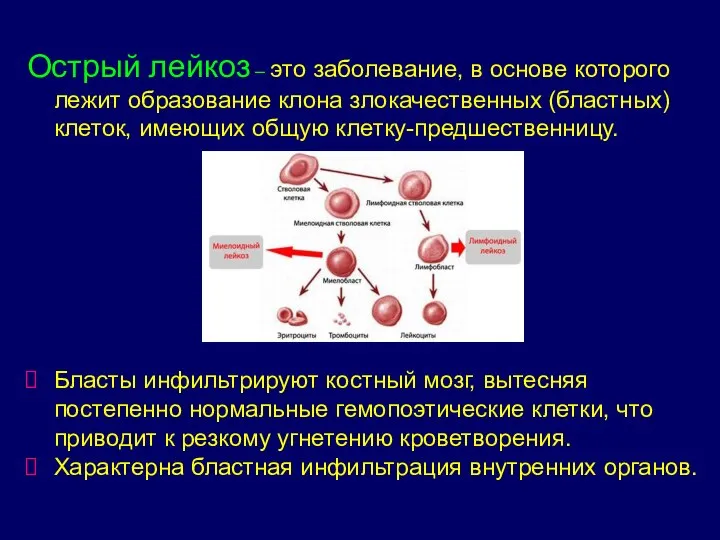 Острый лейкоз – это заболевание, в основе которого лежит образование клона злокачественных