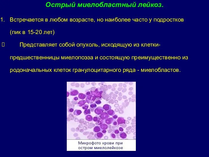 Острый миелобластный лейкоз. Встречается в любом возрасте, но наиболее часто у подростков