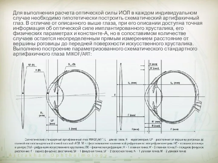 Для выполнения расчета оптической силы ИОЛ в каждом индивидуальном случае необходимо гипотетически