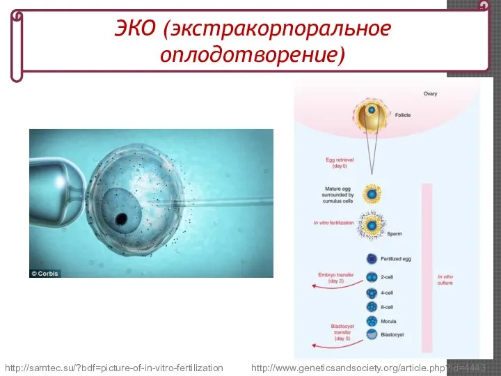 http://www.geneticsandsociety.org/article.php?id=4443 ЭКО (экстракорпоральное оплодотворение) http://samtec.su/?bdf=picture-of-in-vitro-fertilization