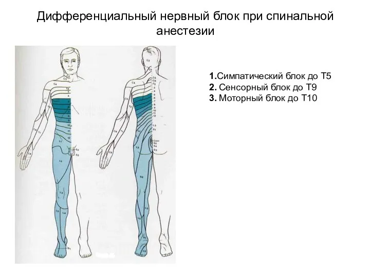 Дифференциальный нервный блок при спинальной анестезии 1.Симпатический блок до Т5 2. Сенсорный