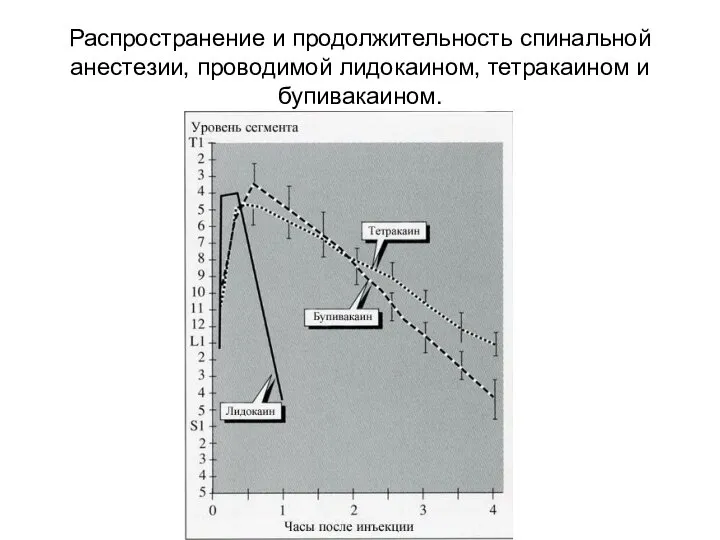 Распространение и продолжительность спинальной анестезии, проводимой лидокаином, тетракаином и бупивакаином.