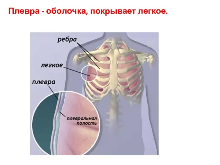 Плевра - оболочка, покрывает легкое.