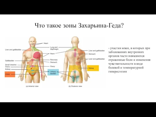 Что такое зоны Захарьина-Геда? - участки кожи, в которых при заболеваниях внутренних