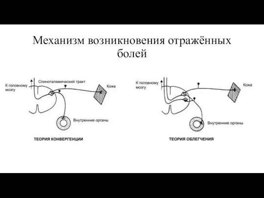 Механизм возникновения отражённых болей